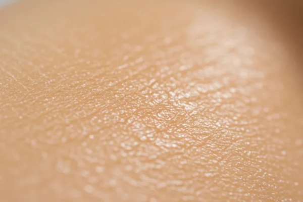 Post-Wax Bumps: Avoid Folliculitis in 2026
